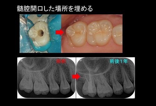 2022年5月アーカイブ - EE DENTAL_Blog